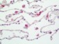 Anti-HLA-DPB1 Antibody 